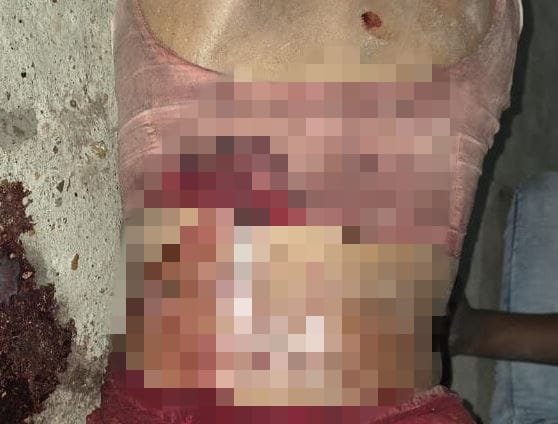 पूर्वी चंपारण में महिला की संदिग्ध हालात में गोली मारकर हत्या, पुलिस जांच में बेटा संदेह के घेरे में
